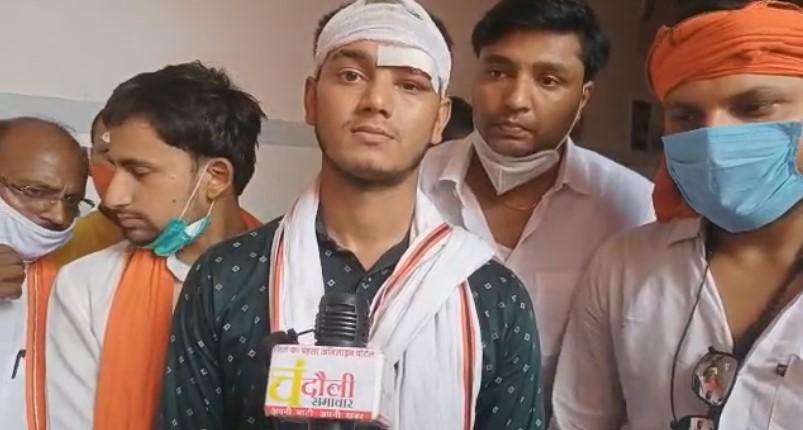 मुगलसराय पुलिस ने हल्की धाराओं में दर्ज किया मुक़दमा, चोट है गंभीर