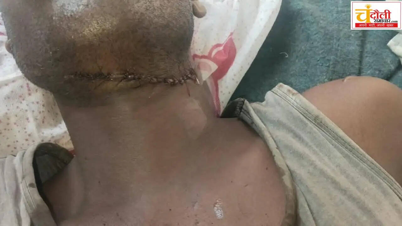 chandauli-masked-bikers-attack-youth-shahabganj-police-investigation